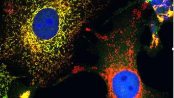 Curbing the cell stress response Curbing the cell stress response